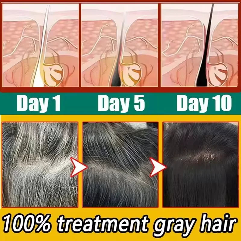 Herbal Anti-grey Hair Treatment Serum Cream White To Black Permanent Repair Natural Color Nourish Scalp Hair Care Products