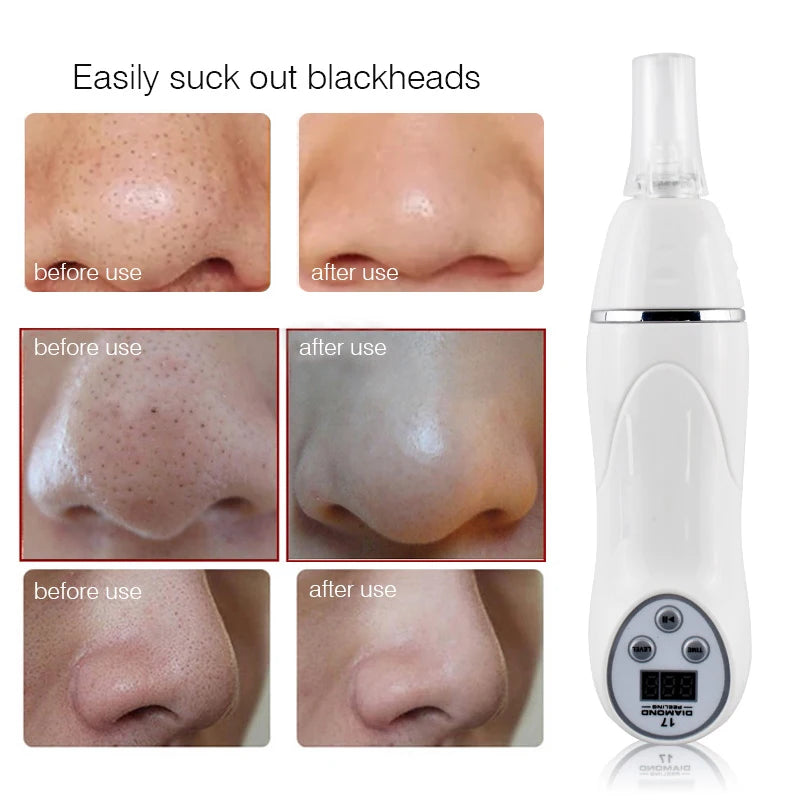 Dermabrasion Exfoliating Blackhead Acne Pore Remove Facial Skin Care Beauty Machine Rechargeable Face Diamond Pen Home Beauty