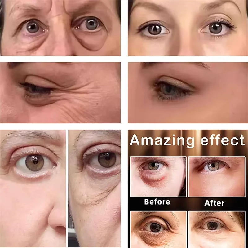 Fast Instant Eye Bag Removal Cream Collagen Removal Wrinkles Firming Skin Fade Fine Lines Brighten Dark Circle Remove Eye Care