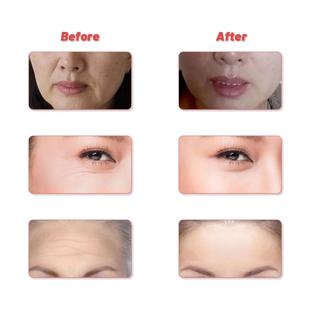 24K Gold Roller Vibrating Facial Massager Slimming Facial Skin Beauty Pulse Firming Face Massage Lift Tightening Wrinkle Bar