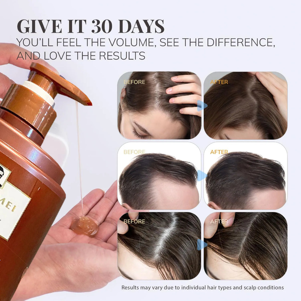 500ml Anti Hair Loss Shampoo Ginger Ingredient Strengthening Hair Root Nourishing Dryness Hair Damaged Repair Thicker Treatment