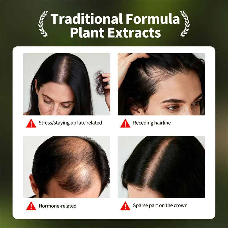 Usman Handmade Shampoo Soap Usman Grass Hair Growth Oil Anti Hair Loss Serum Hair Regrowth Spray Scalp Care Oil for Men Women