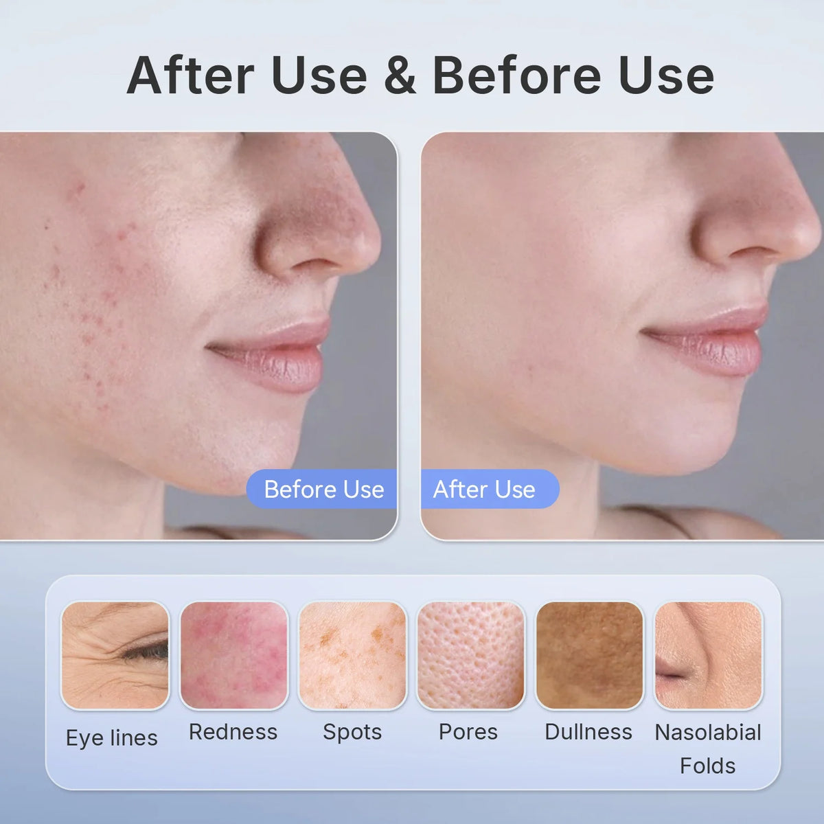 Photonic Skin Rejuvenation Device LED Red and Blue Light Facial Mask Therapeutic Facial Phototherapy Instrument