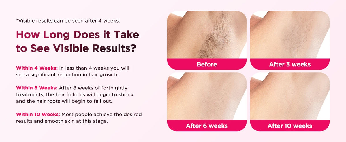 IPL Hair Removal Device Ice-Cooling 3 in 1 Painless 16J Photoepilator Permanent Whole Body Facial Bilinis Leg Home Treament For Men and Women