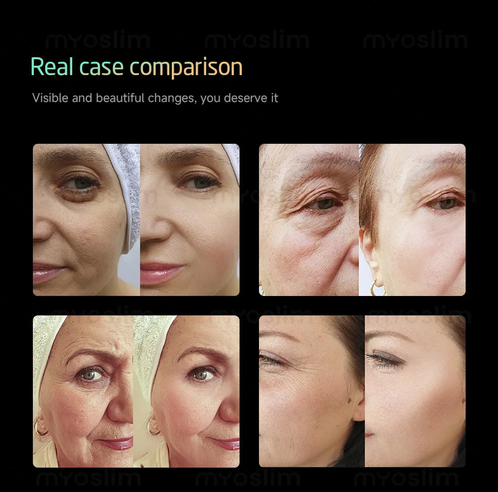 25D 360MAX 3-in-1 Beauty Equipment Ultrasound Technology for Facial Lifting Slimming and Body Firming Non-Invasive Salon Machine