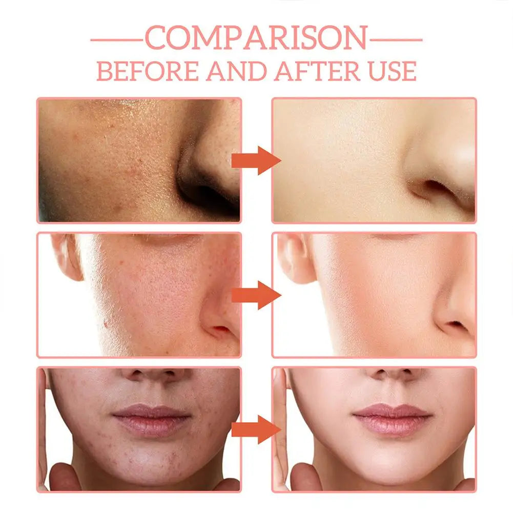 5 In 1 Face Serum Moisturizing Whitening Anti Wrinkle Aging Vitamin C Hyaluronic Acid Facial Serum Shrink Pores Skin Care 30ml