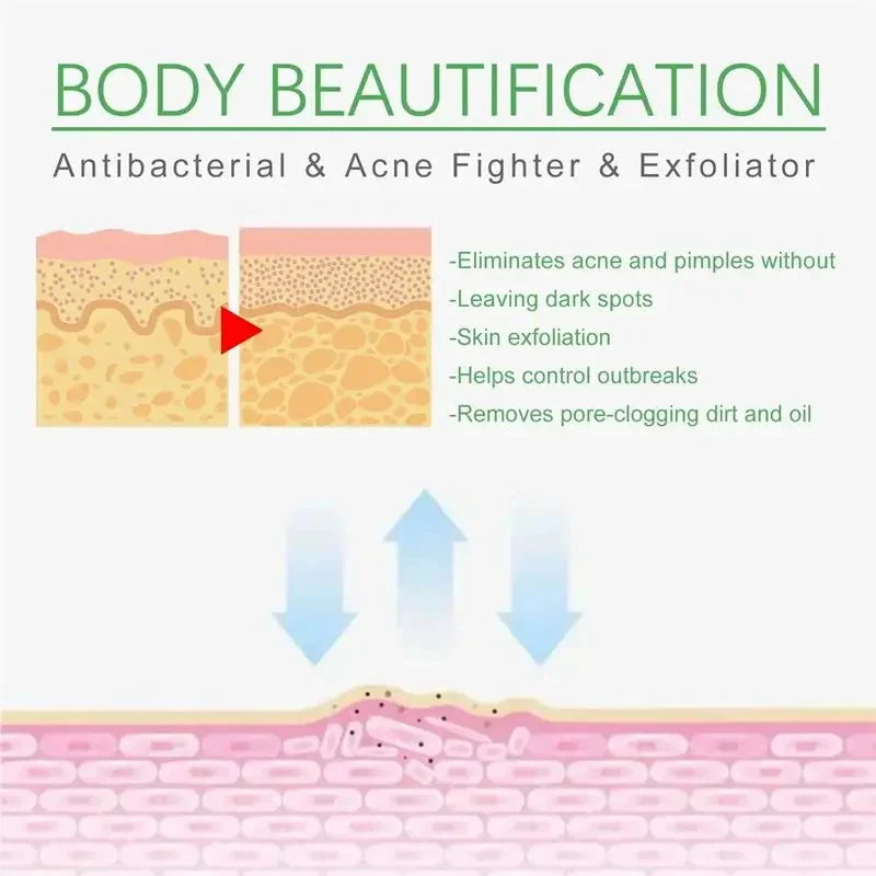 Salicylic Acid Acne Treatment Face Cream Repair Pimple Spots Deep Cleaning Pore Anti-acne Scar Oil Control Moisturizer Skin Care